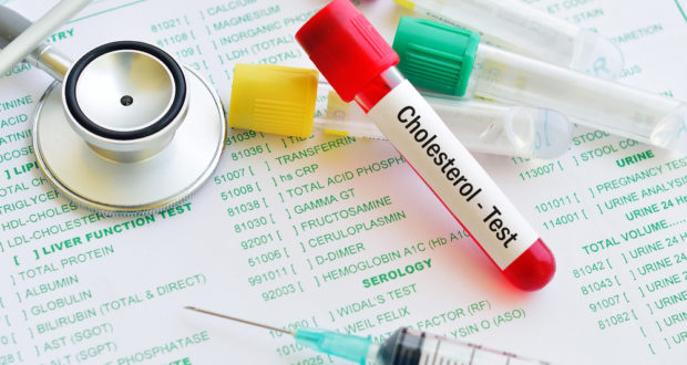 CHOLESTEROL TESTING - Watsons Health