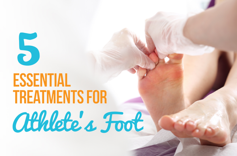 5 Essential Treatments for Athlete’s Foot
