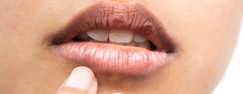 5 Oral Problems and How to Treat Them 