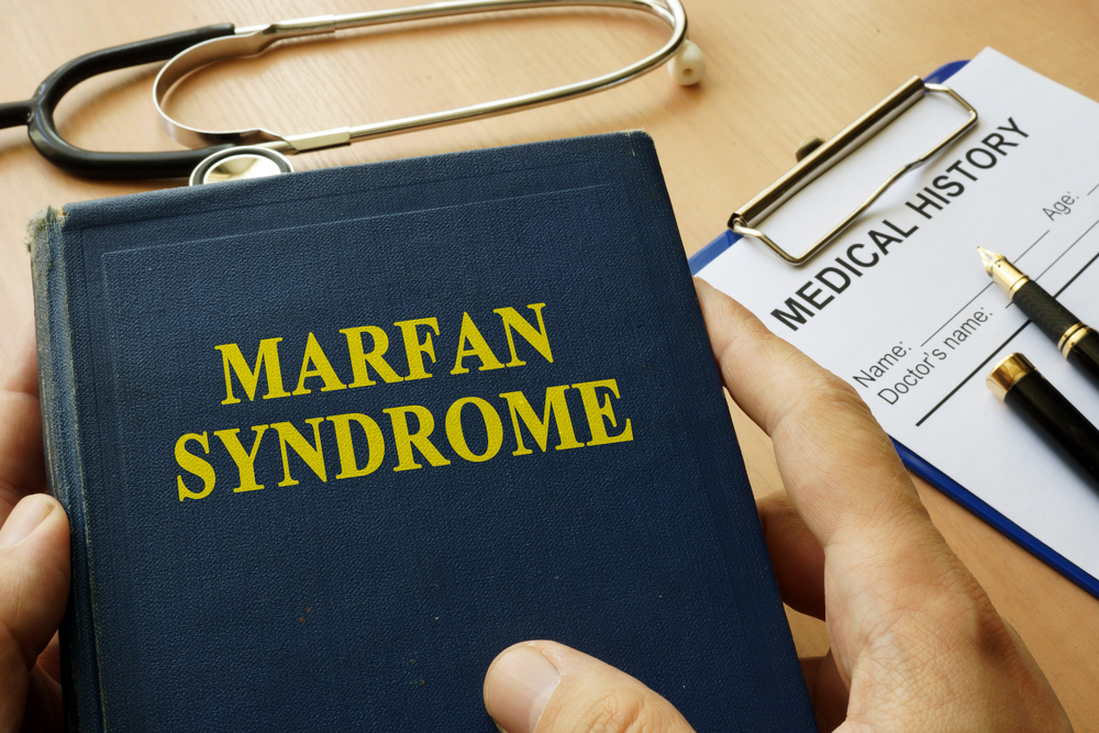 MARFAN SYNDROME - WatsonsHealth