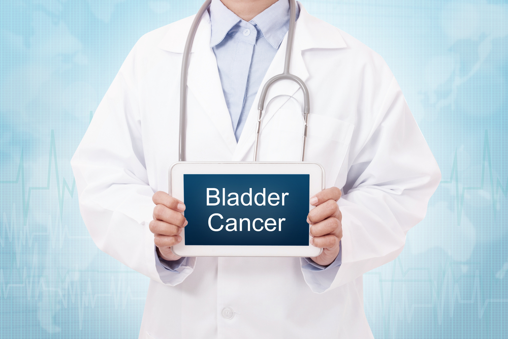bladder cancer - WatsonsHealth