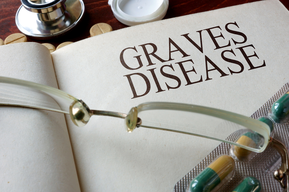 GRAVES' DISEASE