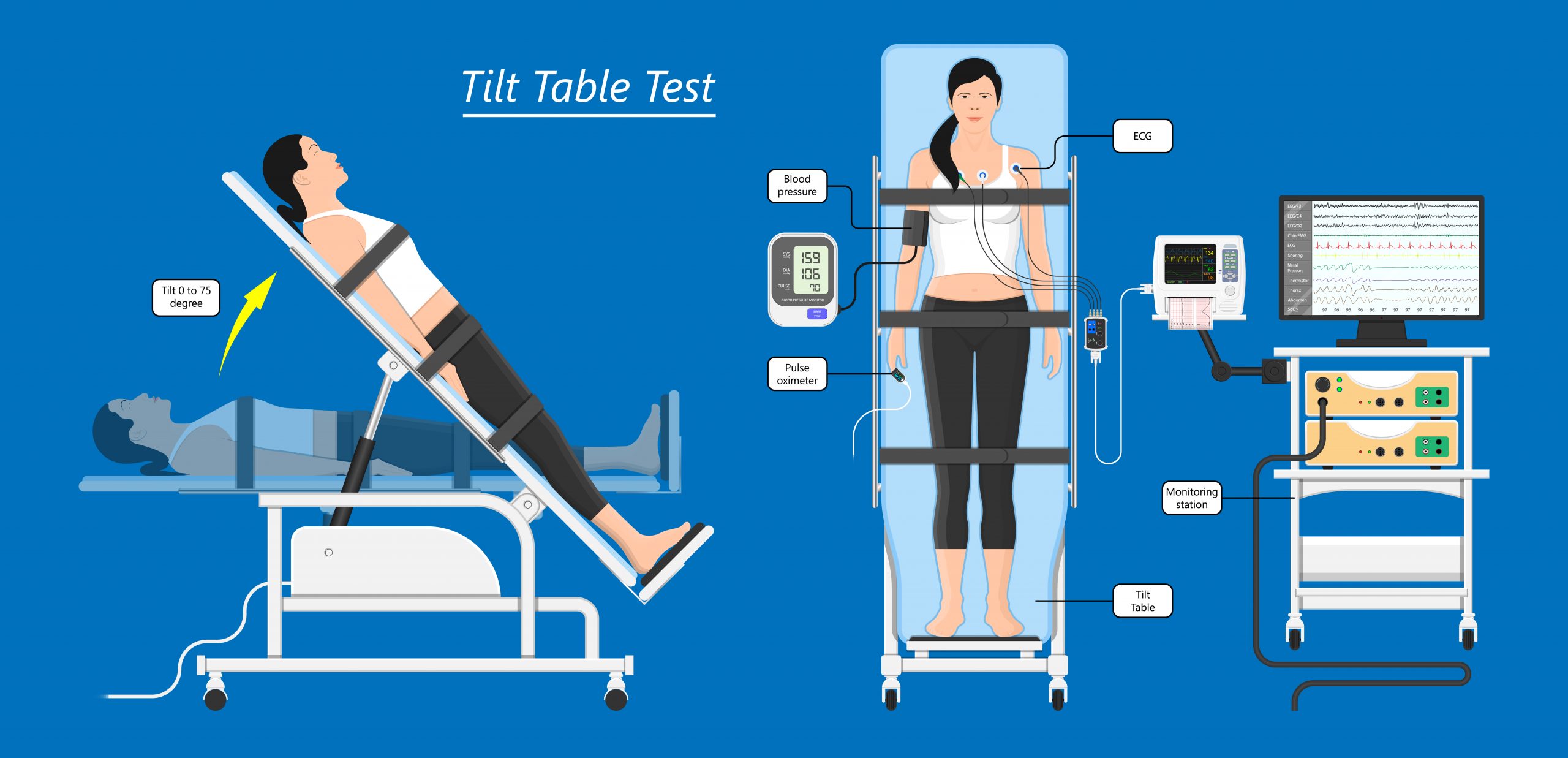 Tilt Table Test in El Paso, TX