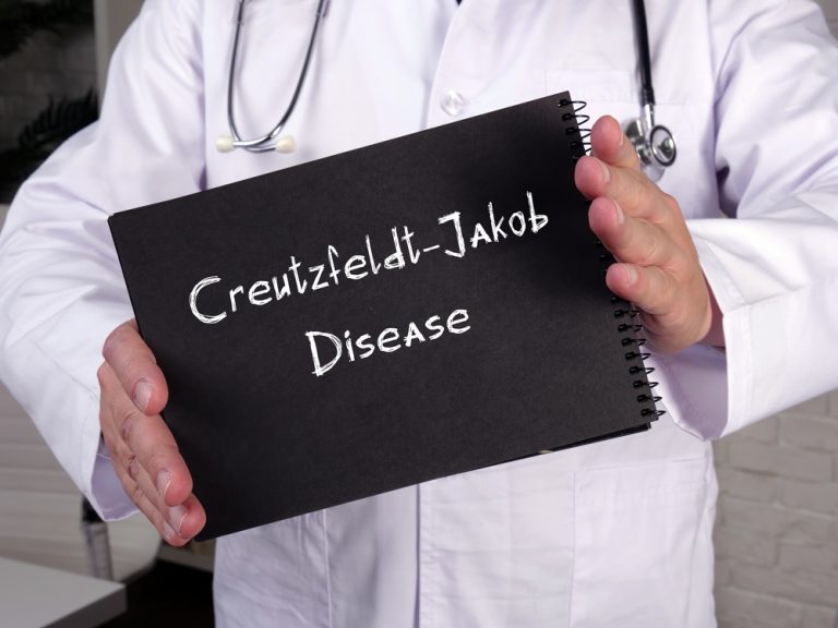 CREUTZFELDT-JAKOB DISEASE