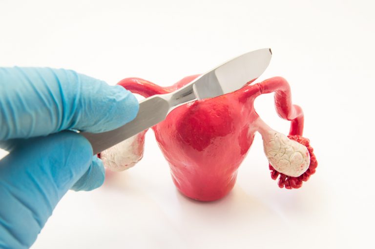 fallopian-tube-removal