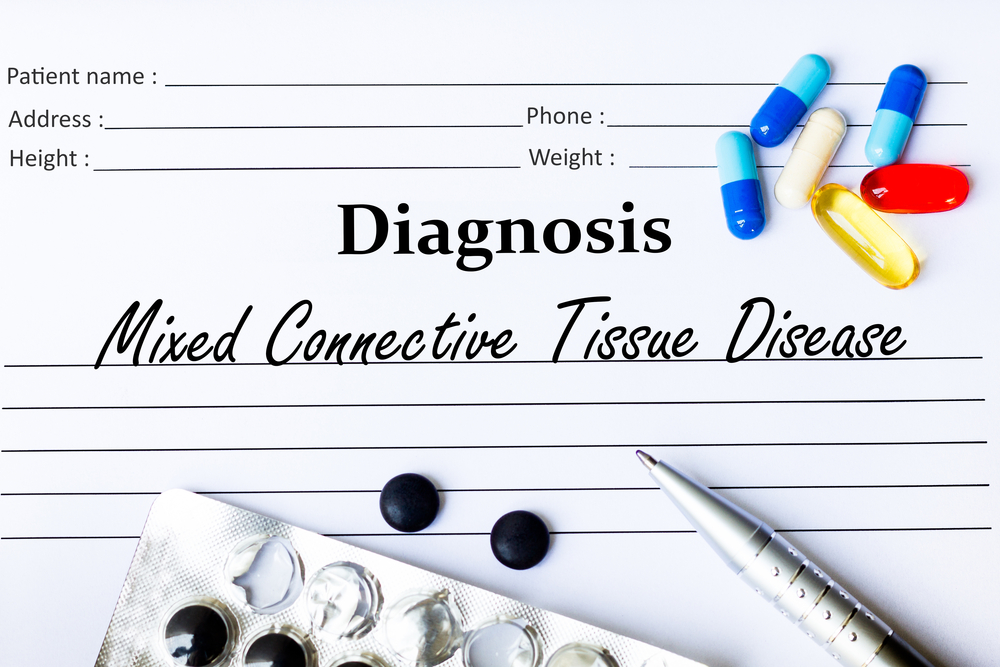 CONNECTIVE TISSUE DISEASE