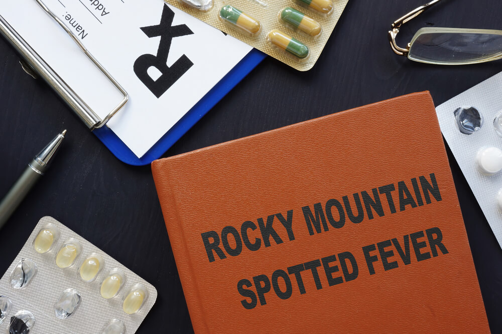 ROCKY MOUNTAIN SPOTTED FEVER